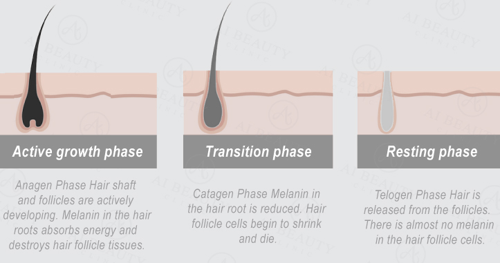 Cynosure Elite+™ Laser Hair Removal - Ai Beauty Clinic