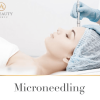 Microneedling 1 session