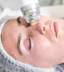 hooded eyes treatment