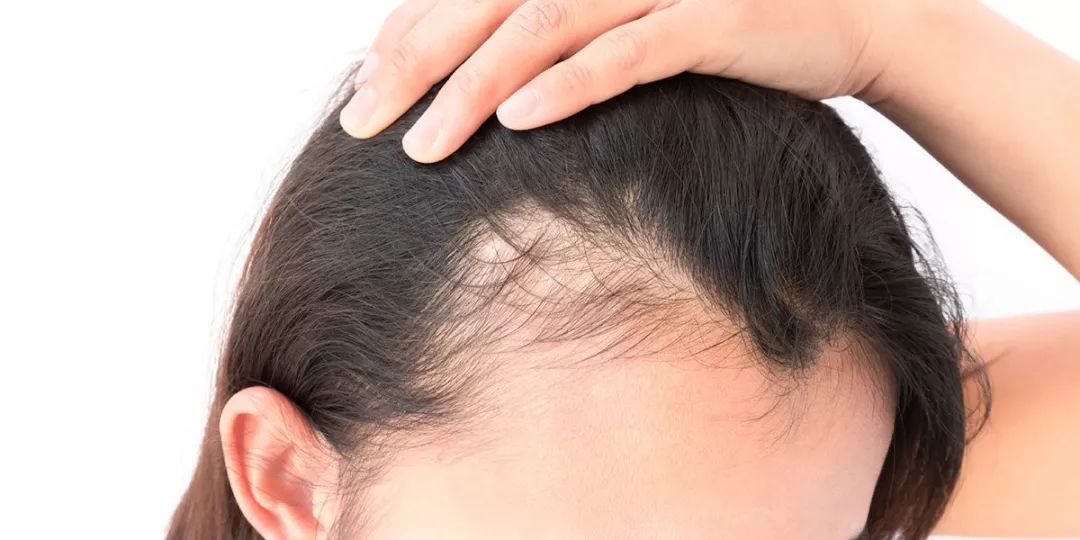 Mature Hairline vs. Receding: How to Tell the Difference