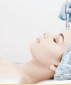 Microneedling