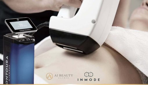 Morpheus8 (Full face+Neck+Eye area) 6 sessions