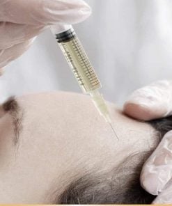 PRP Skin Treatment