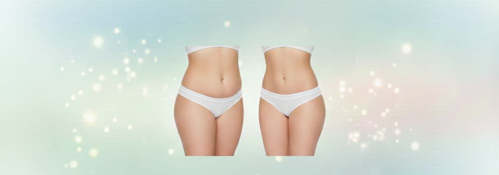 images of body contouring before and after