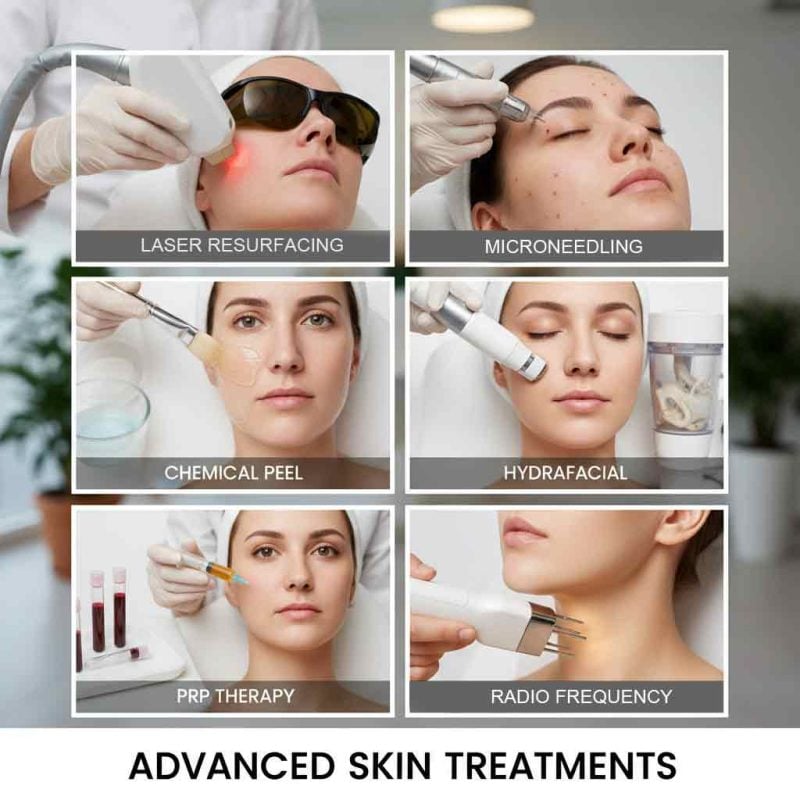 Skin treatments London